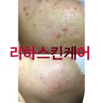 리하스킨케어