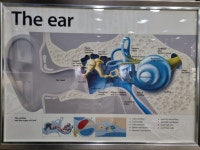 울산대 다비나안경보청기