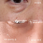 럭셔리뷰티 연신내점 | 더뷰티안 속눈썹 연신내점