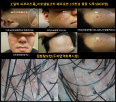 팜퓨리 스칼프메디슨 일산본점