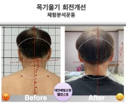 대전체형교정 밸런스핏