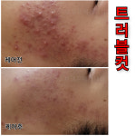 보엘르 에스테틱 이지다