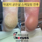 레푸스 수성점