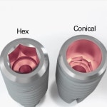 에스아이씨인벤트아시아퍼시픽