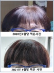 하라힐즈헤나. 탈모관리.두피케어