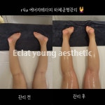 에끌라 영 에스테틱