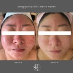 세리영스킨케어