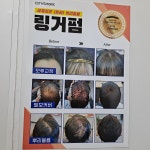 큐헤어