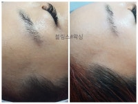 블링스왁싱 노원점