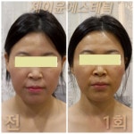 제이윤 에스테틱