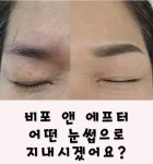 미비포유