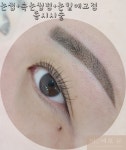 미비포유