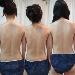 송송테라피