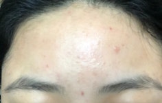 나나스킨케어&왁싱