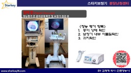 스타키보청기 분당난청센터