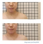 윤권희 피부관리소 | 윤권희 피부연구소