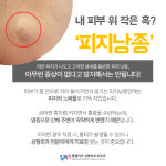 몽벨리아성형외과의원