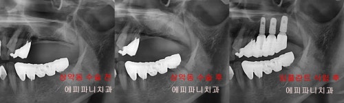 에피파니치과의원