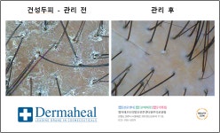 엠지에프 두피탈모 전문센터 원주의료원점