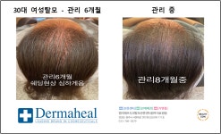 엠지에프 두피탈모 전문센터 원주의료원점