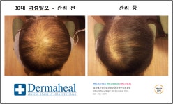 엠지에프 두피탈모 전문센터 원주의료원점