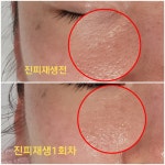 새온뷰티 두골비얼굴축소연구소