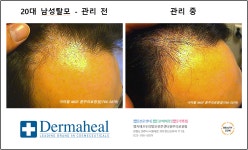 엠지에프 두피탈모 전문센터 원주의료원점