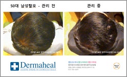 엠지에프 두피탈모 전문센터 원주의료원점