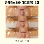 선유 스킨바디