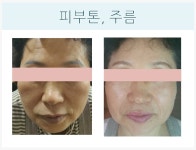 더 끌리지 피부샵
