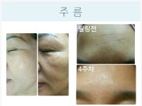 더 끌리지 피부샵