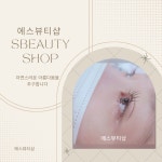 에스뷰티샵 피부 두피 발각질 의정부점