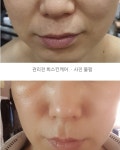 희 : 스킨케어