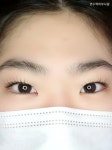 피부사랑