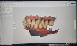서울OK치과의원