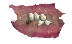 스마일라인치과기공소