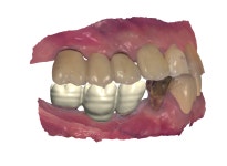 스마일라인치과기공소