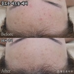 물오른피부 창원점