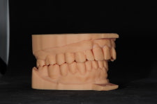 스마일라인치과기공소