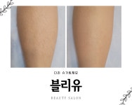 블리유