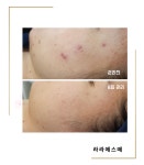 라라에스떼/ 얼굴축소연구소