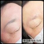 렛미인 뷰티