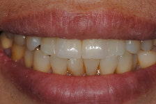 다온치과기공소