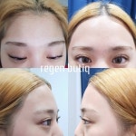 리젠왁싱앤드스킨케어 | 리젠왁싱&스킨케어