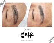 블리유