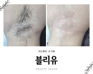 블리유
