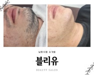 블리유