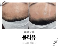 블리유