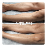 슈가엘뷰티 슈가링왁싱 민락점