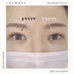 스칼프랩앤뷰티